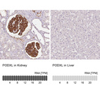 Anti-PODXL Antibody