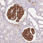 Immunohistochemical staining of human kidney shows strong membranous positivity in cells in glomeruli, as well as endothelial cells.