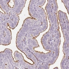 Immunohistochemical staining of human fallopian tube shows strong positivity in apical membranes in glandular cells.