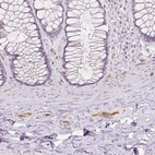Immunohistochemical staining of human rectum shows moderate membranous positivity in endothelial cells.