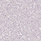 Immunohistochemical staining of human liver shows no positivity in hepatocytes as expected.