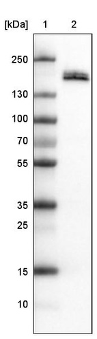 Lane 1: Marker [kDa]_br/_Lane 2: Human kidney tissue lysate