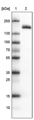 Lane 1: Marker [kDa]_br/_Lane 2: Human kidney tissue lysate