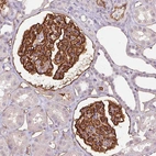 Immunohistochemical staining of human kidney shows strong membranous positivity in cells in glomeruli, as well as endothelial cells.