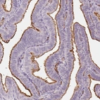 Immunohistochemical staining of human fallopian tube shows strong positivity in apical membranes in glandular cells.