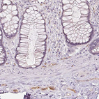 Anti-PODXL Antibody