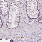 Immunohistochemical staining of human rectum shows moderate membranous positivity in endothelial cells.