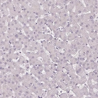 Immunohistochemical staining of human liver shows no positivity in hepatocytes as expected.