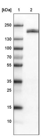 Lane 1: Marker [kDa]_br/_Lane 2: Human kidney tissue lysate