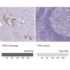 Anti-TTR Antibody