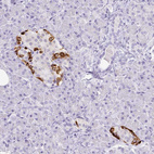 Anti-TTR Antibody