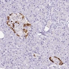 Immunohistochemical staining of human pancreas shows strong cytoplasmic positivity in a subset of endocrine glandular cells.