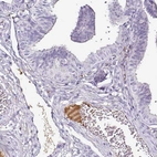 Immunohistochemical staining of human fallopian tube shows moderate positivity in plasma in blood vessels.