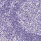 Anti-TTR Antibody