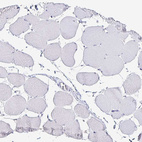 Anti-TTR Antibody