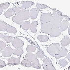 Immunohistochemical staining of human skeletal muscle shows no positivity in myocytes as expected.