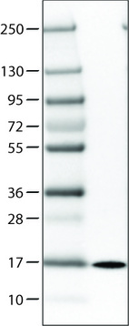 Lane 1: Marker [kDa]_br/_Lane 2: Human plasma