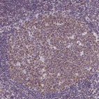 Anti-RBM3 Antibody