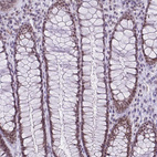 Immunohistochemical staining of human rectum shows moderate nuclear positivity in glandular cells.
