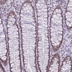Immunohistochemical staining of human rectum shows moderate nuclear positivity in glandular cells.
