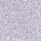 Anti-RBM3 Antibody