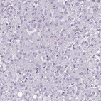 Immunohistochemical staining of human liver shows no positivity in hepatocytes as expected.