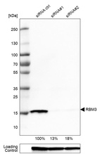 Western blot analysis in U-251MG cells transfected with control siRNA, target specific siRNA probe #1 and #2, using Anti-RBM3 antibody. Remaining relative intensity is presented. Loading control: Anti-GAPDH.