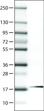Lane 1: Marker [kDa]_br/_Lane 2: Human cell line RT-4