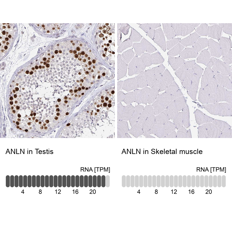 Anti-ANLN Antibody