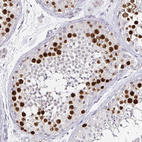 Immunohistochemical staining of human testis shows moderate to strong nuclear positivity in a subset of cells in seminiferous ducts.