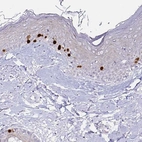 Immunohistochemical staining of human skin shows moderate to strong nuclear positivity in a subset of dermal cells.