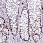Immunohistochemical staining of human rectum shows moderate to strong nuclear positivity in a subset of glandular cells.