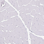 Immunohistochemical staining of human skeletal muscle shows no nuclear positivity in striated muscle fibers as expected.
