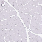 Immunohistochemical staining of human skeletal muscle shows no nuclear positivity in striated muscle fibers as expected.