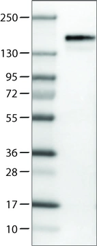 Lane 1: Marker [kDa]_br/_Lane 2: Human cell line U-251 MG