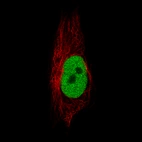 Immunofluorescence staining of U-251 cells using the Anti-ATAD2 monoclonal antibody, showing specific staining in nucleoplasm in green. Microtubule- and nuclear probes are visualized in red and blue, respectively (where available).