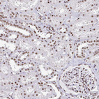 Anti-CTCF Antibody