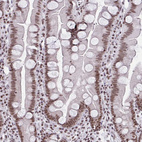 Anti-CTCF Antibody