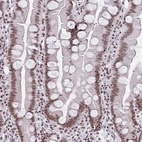 Immunohistochemical staining of human small intestine shows moderate nuclear positivity in glandular cells.