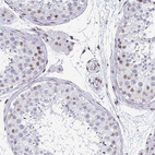 Anti-CTCF Antibody