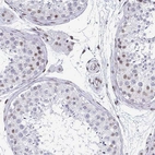Immunohistochemical staining of human testis shows moderate nuclear positivity in a subset of cells in seminiferous ducts.