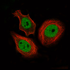 Anti-CTCF Antibody