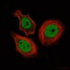 Immunofluorescence staining of MCF7 cells using the Anti-CTCF monoclonal antibody, showing specific staining in the nucleoplasm in green. Microtubule- and nuclear probes are visualized in red and blue, respectively (where available).
