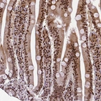 Immunohistochemical staining of human small intestine shows strong nuclear positivity in glandular cells.