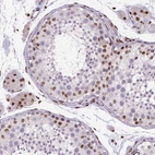 Immunohistochemical staining of human testis shows moderate nuclear positivity in a subset of cells in seminiferous ducts.