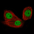 Anti-CTCF Antibody