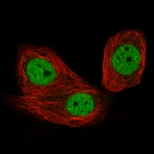 Immunofluorescence staining of MCF7 cells using the Anti-CTCF monoclonal antibody, showing specific staining in the nucleoplasm in green. Microtubule- and nuclear probes are visualized in red and blue, respectively (where available).