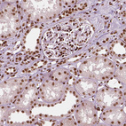 Anti-CTCF Antibody