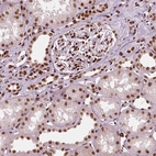 Immunohistochemical staining of human kidney shows strong nuclear positivity in cells in glomeruli and tubuli.
