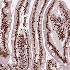 Immunohistochemical staining of human small intestine shows strong nuclear positivity in glandular cells.
